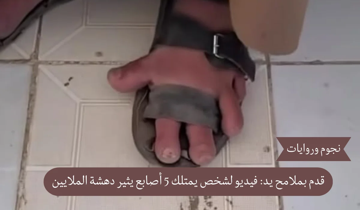 قدم بملامح يد: فيديو لشخص يمتلك 5 أصابع يثير دهشة الملايين
